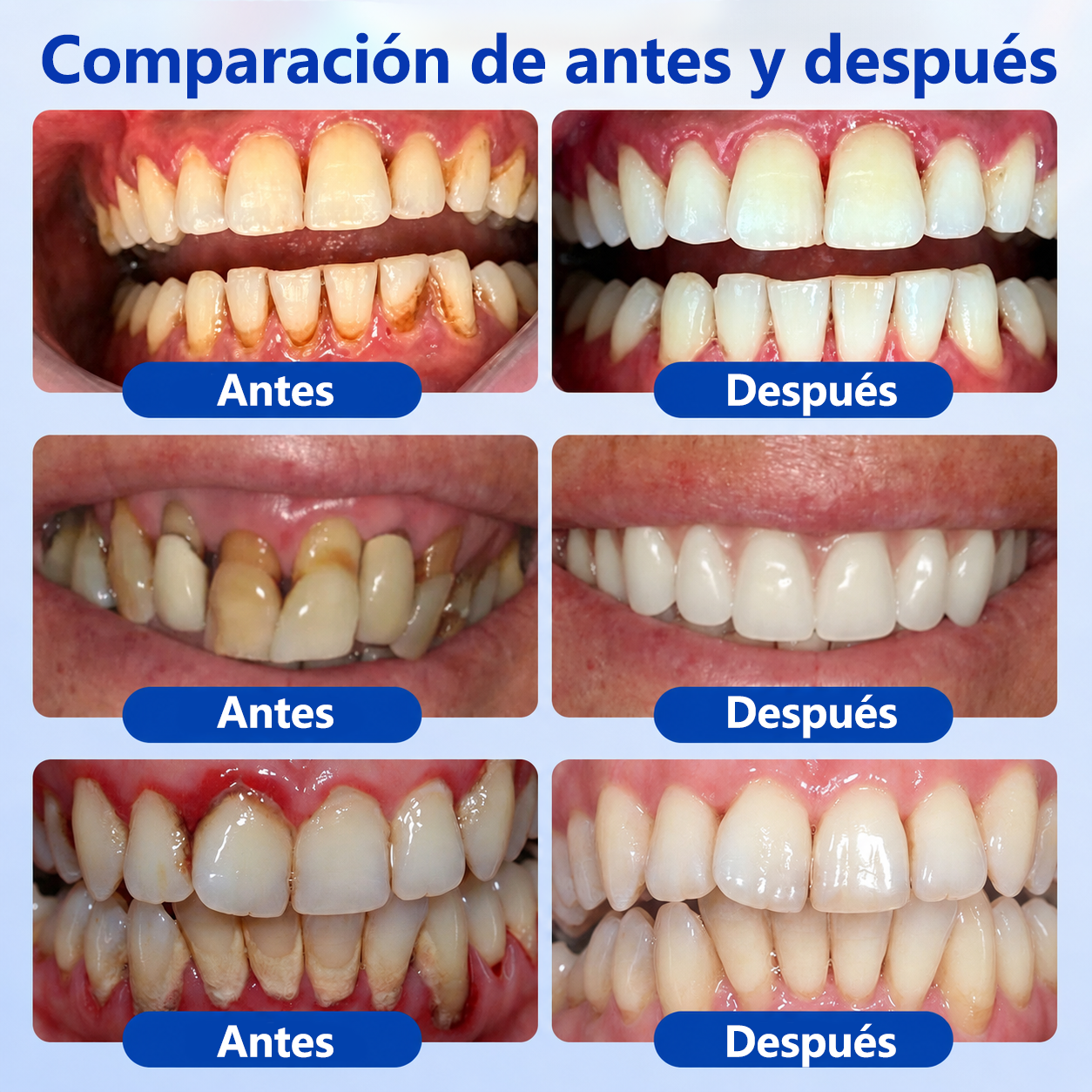 🦷🍧𝑮𝒍𝒊𝒎𝒎𝒆𝒓𝒍𝒚® 𝑮𝒖𝒎𝑹𝒆𝒗𝒊𝒗𝒆 𝑮𝒆𝒍 𝑹𝒆𝒑𝒂𝒓𝒂𝒅𝒐𝒓 𝑷𝒆𝒓𝒊𝒐𝒅𝒐𝒏𝒕𝒂𝒍