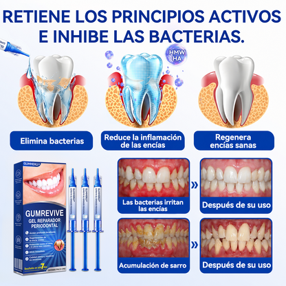🦷🍧𝑮𝒍𝒊𝒎𝒎𝒆𝒓𝒍𝒚® 𝑮𝒖𝒎𝑹𝒆𝒗𝒊𝒗𝒆 𝑮𝒆𝒍 𝑹𝒆𝒑𝒂𝒓𝒂𝒅𝒐𝒓 𝑷𝒆𝒓𝒊𝒐𝒅𝒐𝒏𝒕𝒂𝒍