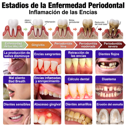 Glimmerly® VioCore TRATAMIENTO PERIODONTAL PARA GINGIVITIS Pasta Dental 🥝
