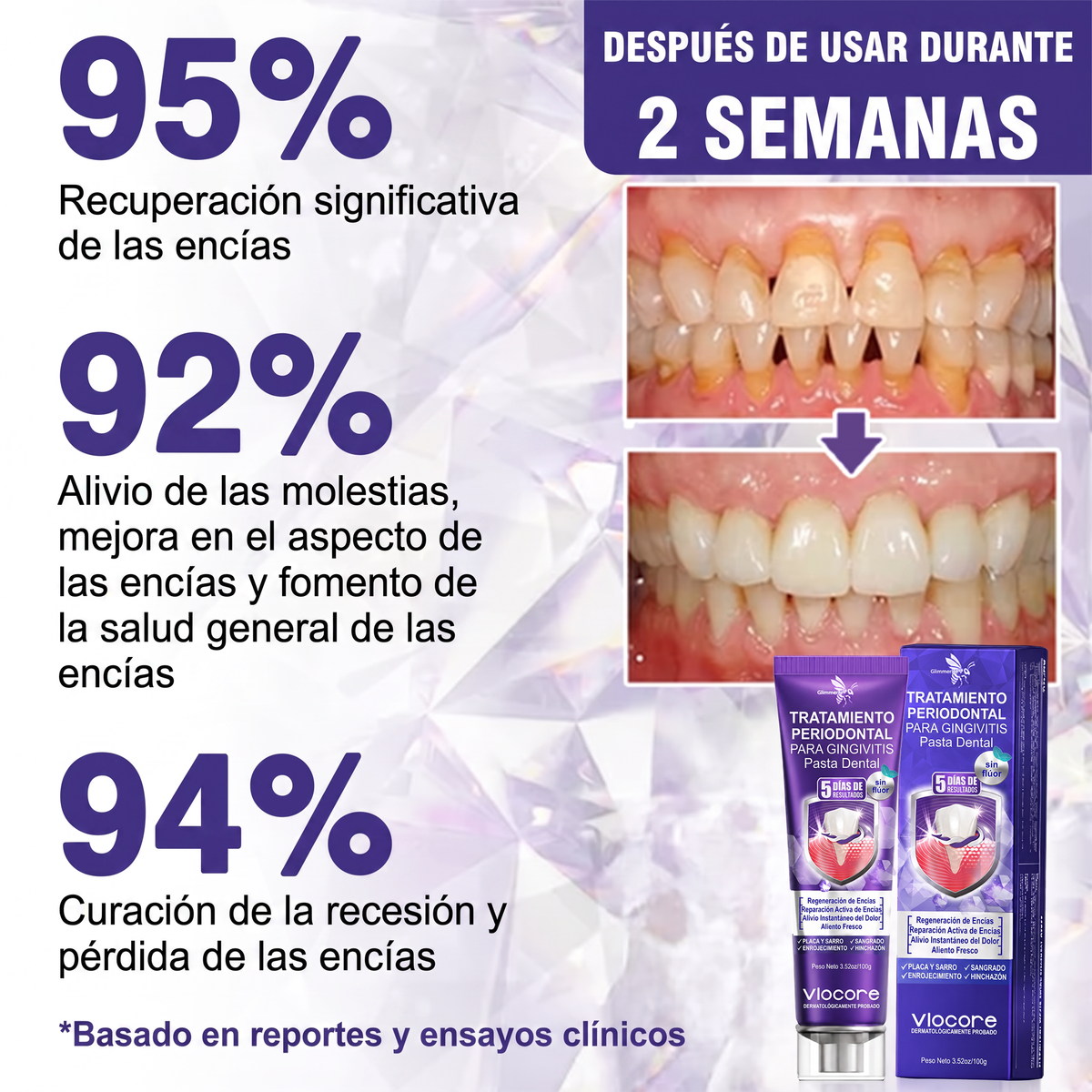 Glimmerly® VioCore TRATAMIENTO PERIODONTAL PARA GINGIVITIS Pasta Dental 🥝