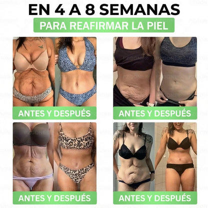 𝑳𝒖𝒙𝒂𝒓𝒊𝒔𝒆® 🍧 Moringa & Berberina 10 en 1 Parche Avanzado de Microagujas Nano (Uso diario, cambios visibles en 7 días) 👩‍⚕️ Obesidad, Diabetes, Apnea del Sueño y Problemas Articulares