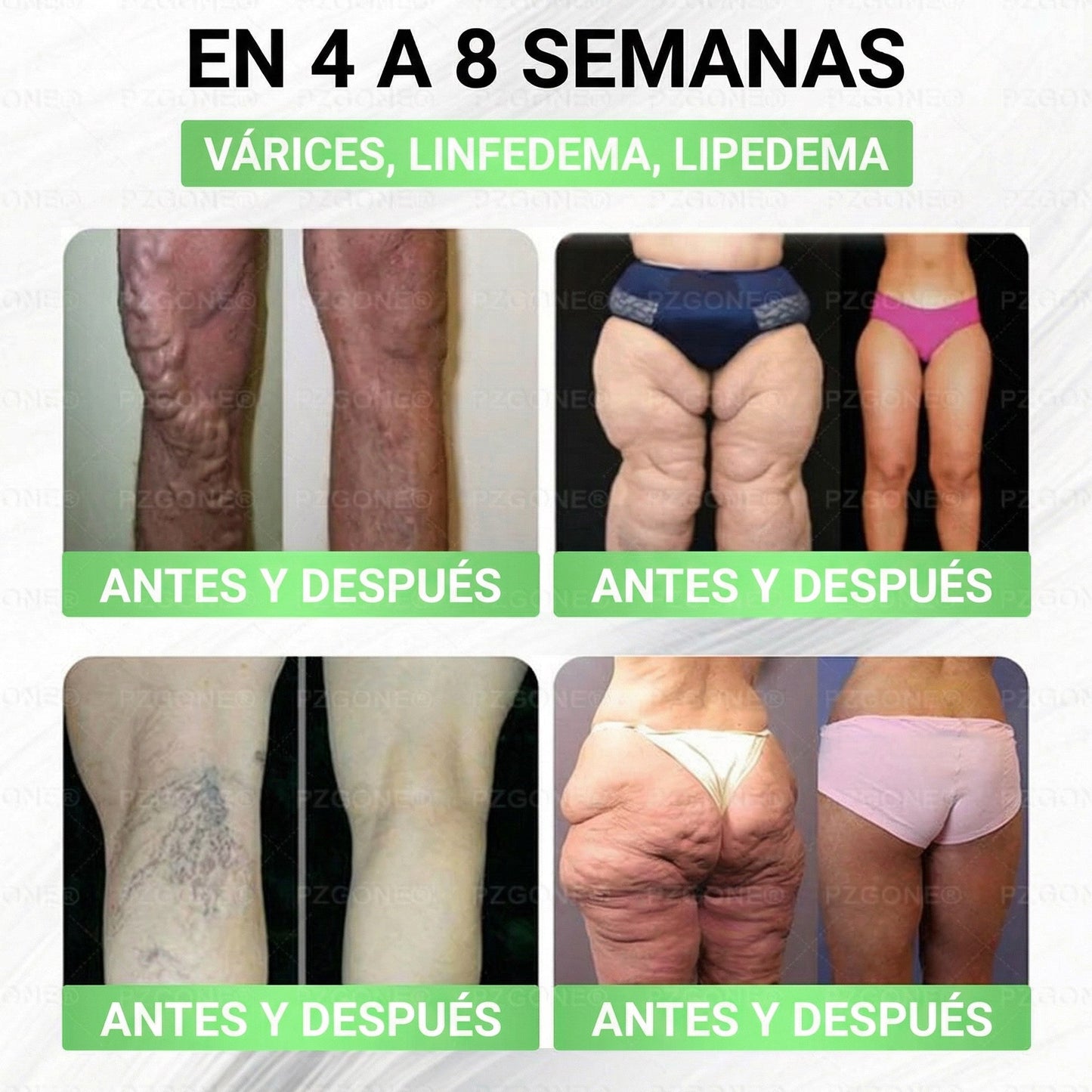 𝑳𝒖𝒙𝒂𝒓𝒊𝒔𝒆® 🍧 Moringa & Berberina 10 en 1 Parche Avanzado de Microagujas Nano (Uso diario, cambios visibles en 7 días) 👩‍⚕️ Obesidad, Diabetes, Apnea del Sueño y Problemas Articulares