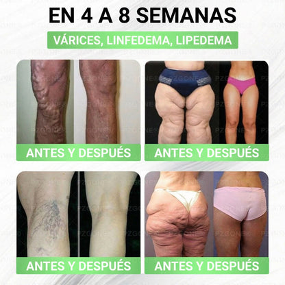 𝑳𝒖𝒙𝒂𝒓𝒊𝒔𝒆® 🍧 Moringa & Berberina 10 en 1 Parche Avanzado de Microagujas Nano (Uso diario, cambios visibles en 7 días) 👩‍⚕️ Obesidad, Diabetes, Apnea del Sueño y Problemas Articulares