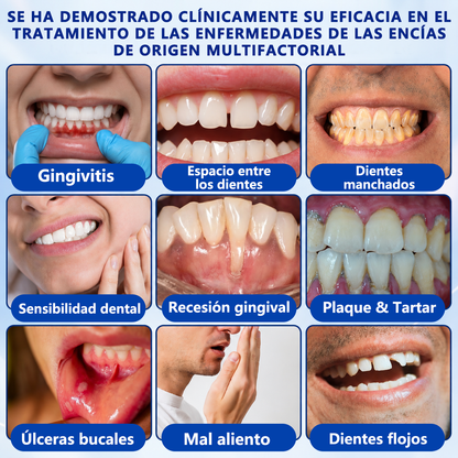 🦷🍧𝑮𝒍𝒊𝒎𝒎𝒆𝒓𝒍𝒚® 𝑮𝒖𝒎𝑹𝒆𝒗𝒊𝒗𝒆 𝑮𝒆𝒍 𝑹𝒆𝒑𝒂𝒓𝒂𝒅𝒐𝒓 𝑷𝒆𝒓𝒊𝒐𝒅𝒐𝒏𝒕𝒂𝒍