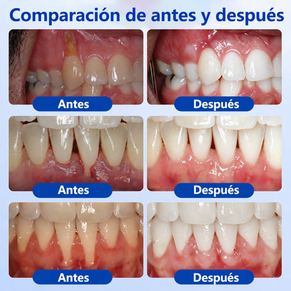 🦷🍧𝑮𝒍𝒊𝒎𝒎𝒆𝒓𝒍𝒚® 𝑮𝒖𝒎𝑹𝒆𝒗𝒊𝒗𝒆 𝑮𝒆𝒍 𝑹𝒆𝒑𝒂𝒓𝒂𝒅𝒐𝒓 𝑷𝒆𝒓𝒊𝒐𝒅𝒐𝒏𝒕𝒂𝒍